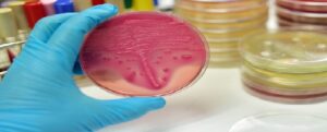 New Project to Improve Diagnosis of Bacterial Infections in Children