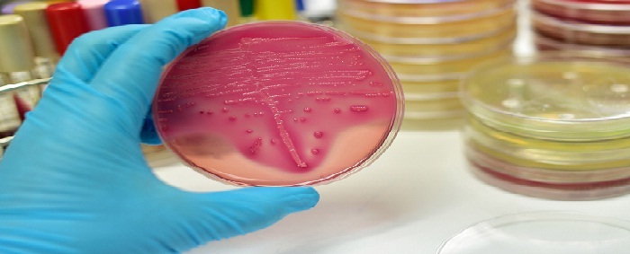 New Project to Improve Diagnosis of Bacterial Infections in Children 61 Untitled2 1