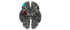 ‘Map’ of Teenage Brain Provides Strong Evidence of Link Between Serious Antisocial Behaviour and Brain Development