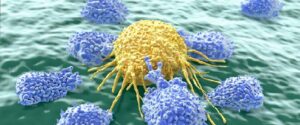 Rare Mutations in Bowel Cancer may Identify Patients with a Better Prognosis