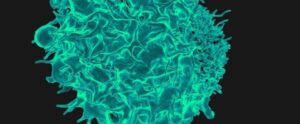 Self-renewable killer cells could be key to making cancer immunotherapy work