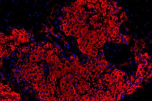 Stem Cells from Jaw Bone Help Repair Damaged Cartilage