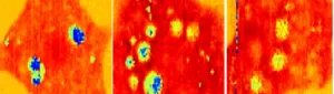 New Ultrasound Technique is First to Image Inside live cells