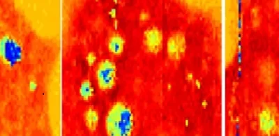 ultrasoundimaging 51 1