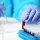 New Blood Test to Detect Liver Damage 1