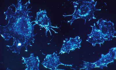Opportunistic Cancer Cells ‘Slip Through the Gaps