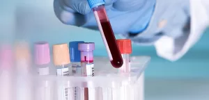 New Test Can Identify If A Patient has Cancer and If It has Spread