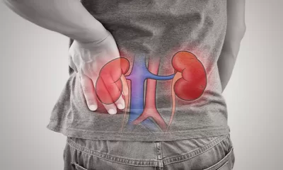 Human Kidney