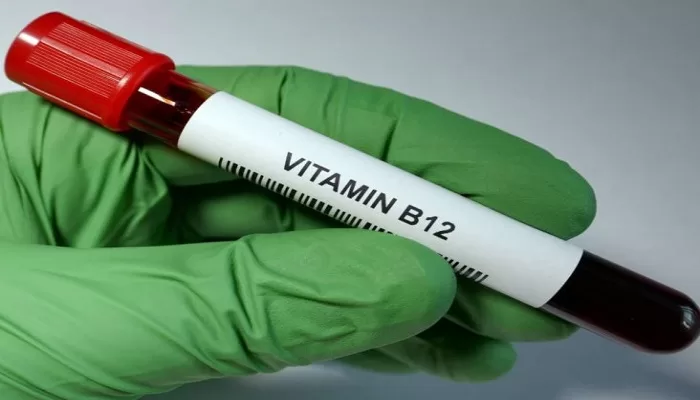 Vitamin B12