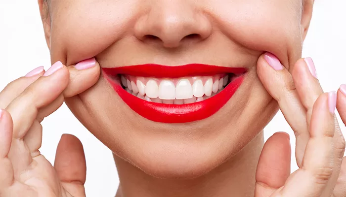 All You Need To Know About Hollywood Smile 61 hollywood-smile