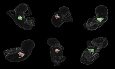 Fetal Shape Analysis