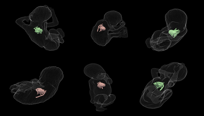 Fetal Shape Analysis