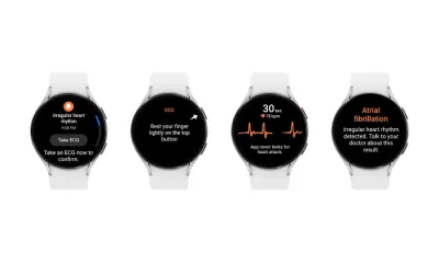 Irregular Heart Rhythm Notification