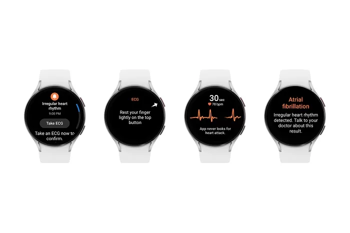 Irregular Heart Rhythm Notification