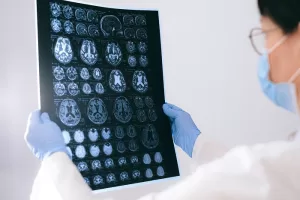 Cannabinoid-Based Drug Trial for Brain Tumours Begins