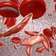 Sickle Cell Disease