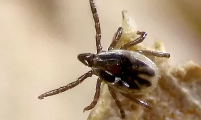 babesiosis