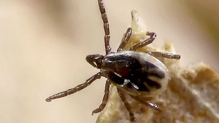 babesiosis