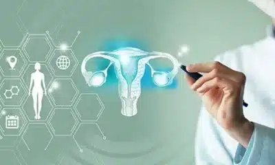 ovarian cancer