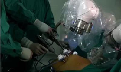 Magnetic Robot's Debut in Chilean Hospital | Surgery