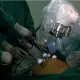 Magnetic Robot's Debut in Chilean Hospital | Surgery