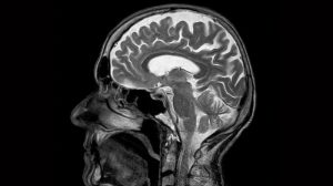 Long-Term Success in Depression Treatment: Cutting-Edge MRI Technique Unveils New Possibilities