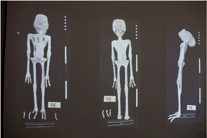 Peruvian 'Alien Mummies' Debunked: Unearthed Specimens Reveal Earthly Origins