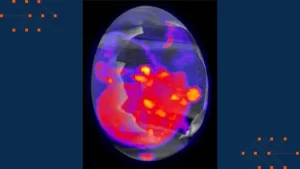 Innovative Insights: Cancer Imaging Explores Chicken Eggs’ Low-Cost Potential