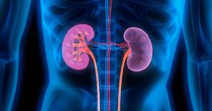 Empowering Patients: Demystifying Unexplained Kidney Disease