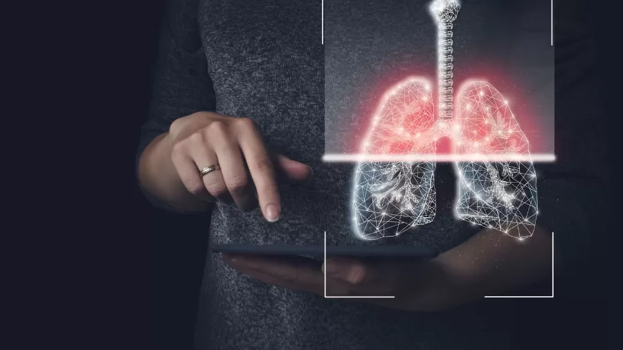 Innovative Lung Scanning Method Offers Real-Time Insights into Lung Function 61 Lung